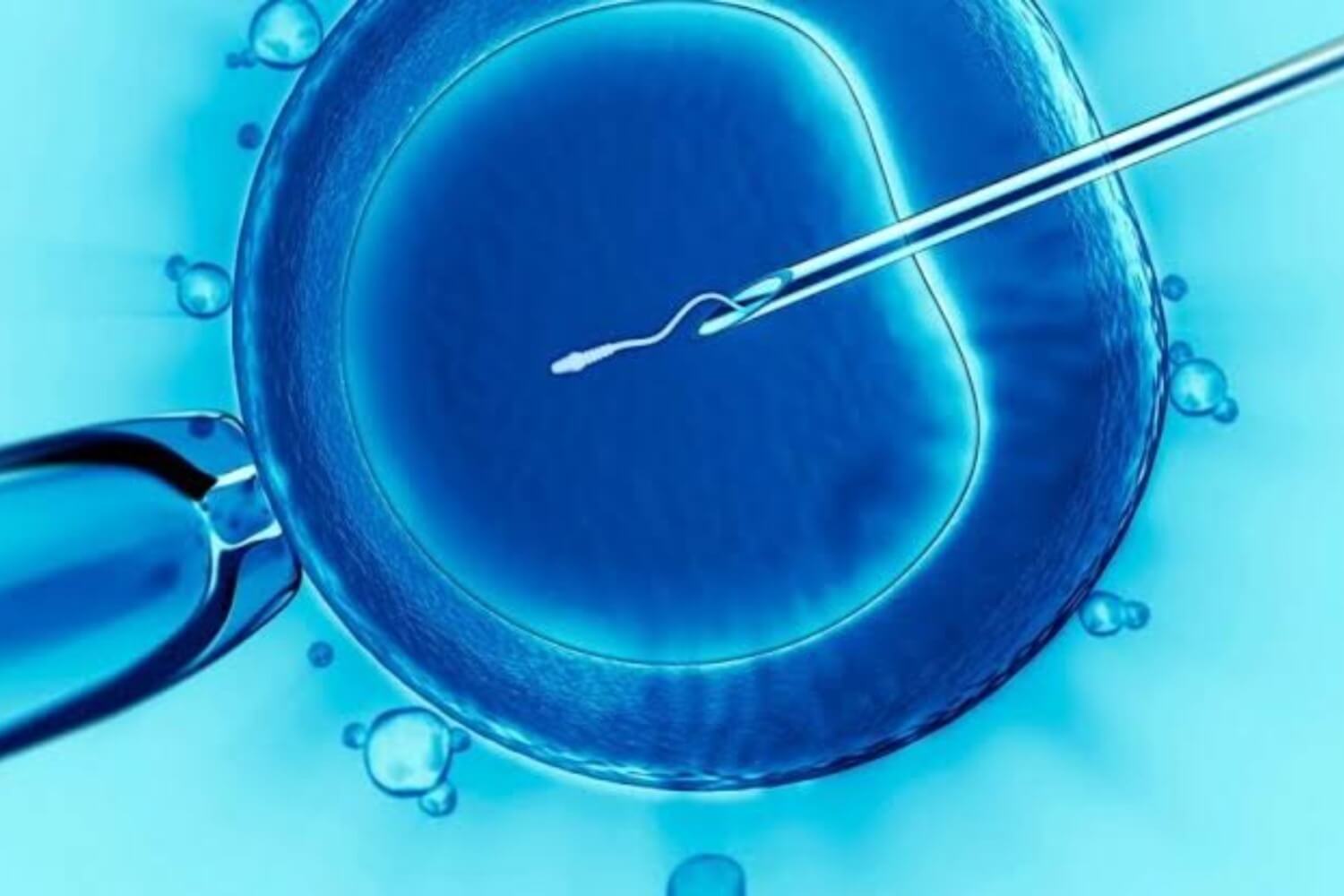 خطوات الحقن المجهرى لتحقيق حلم اللإنجاب